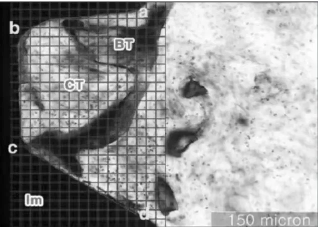 Fig. 2. Morphometry  of  ground  section  (Villanueva bone  stain;  original  magnification  × 100)