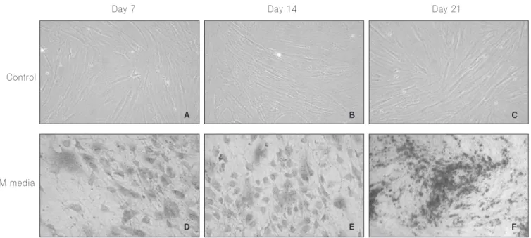 Fig. 3. Alizarin  red  staining  result  of  buccal  fat-derived  cell  (×200).  A,  B,  C:  control  group,  cultured  in  universal media after 7, 14, 21 days respectively