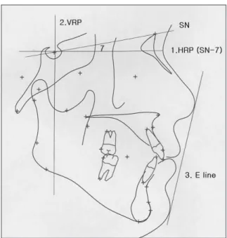 Fig. 2. Reference plane employed in this study.