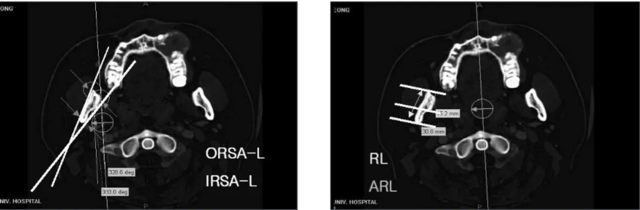 Fig. 3. Angular and linear measurements in the lingular tip level. 