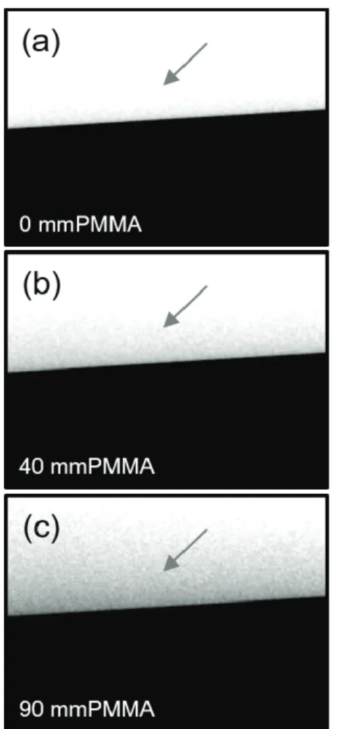 Fig.  2.  Comparison  of  edge-knife  phantom  images  obtained  from  the  PMMA  thickness  with  the  same  120  kVp,  5  mAs  condition