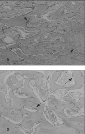 Fig. 3. Immunostaining of osteopontin (OPN) in distracted bone (original magnification ×40)