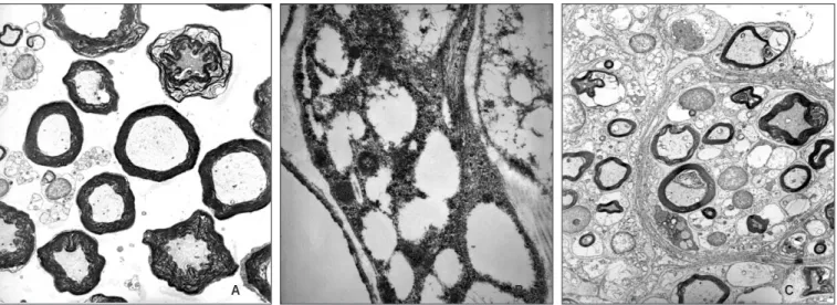 Fig. 14. Transmission electron photomicrographs of cross section in the mid-portion of nerve conduit (×3,000).