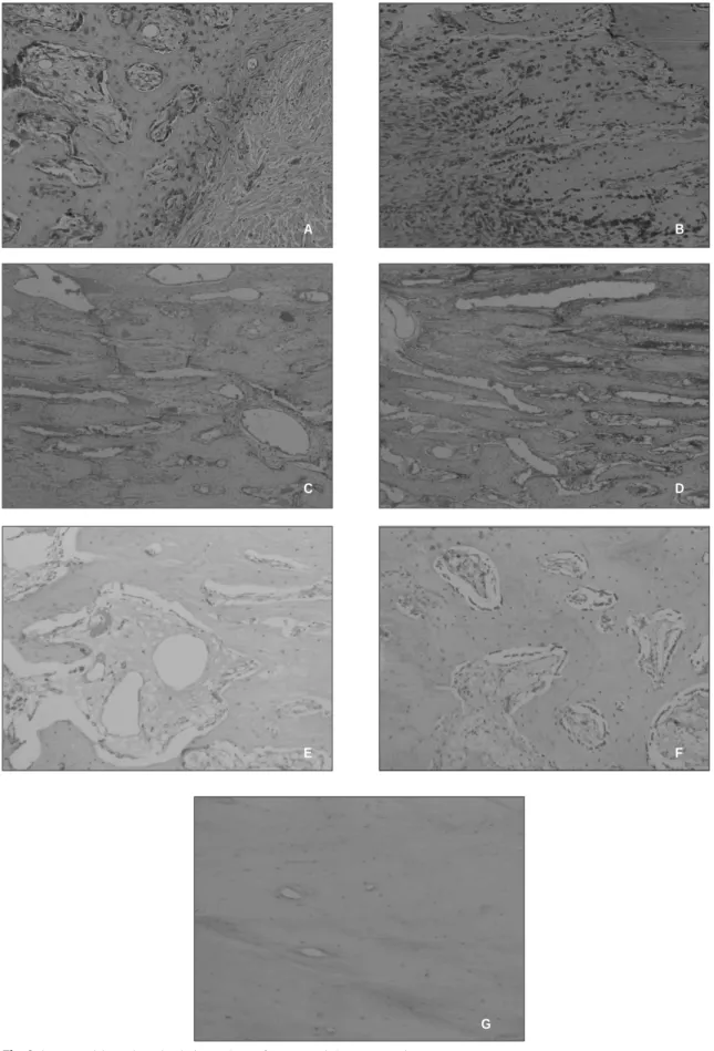 Fig. 6. Immunohistochemical detection of osteocalcin expression.