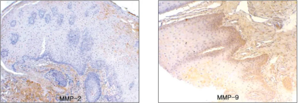 Fig. 1. Immunohistochemical findings showing scattered expression of MMP-2 and MMP-9 in normal mucosa (left:×40, right:×100).