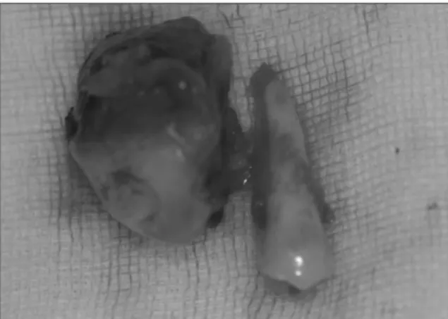 Fig. 5. Conservative excisional margin. Fig. 6. Specimen, continued with second premolar.