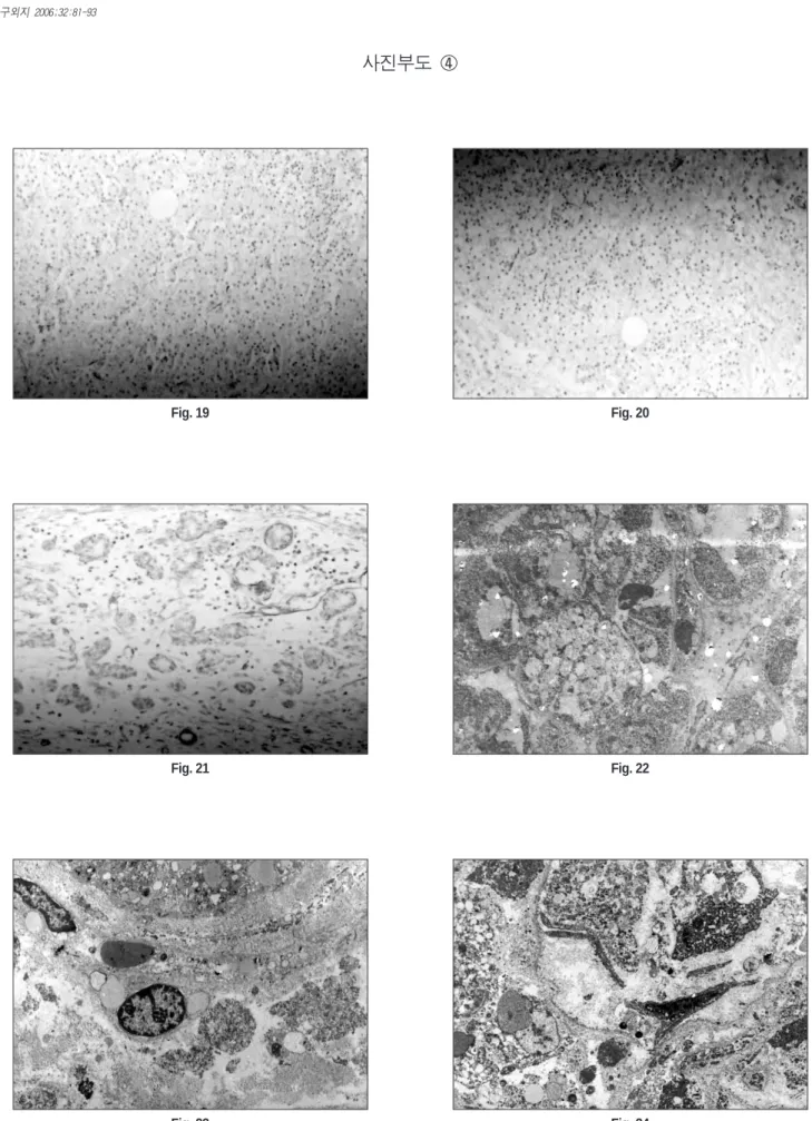 Fig. 19 Fig. 20