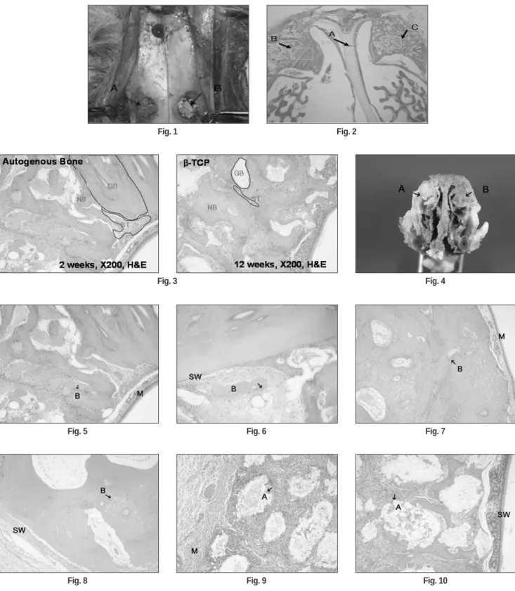 Fig. 1 Fig. 2