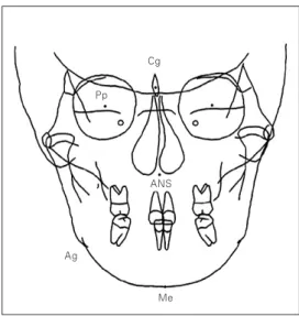 Fig. 1. Lateral cephalometric landmarks.