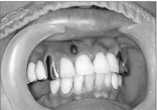Fig. 1. Initial oral view.