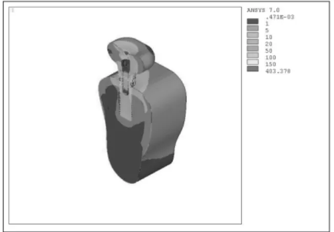 Fig. 12. Comparison of the von Mises stress according to apical-coronal implant position (loading site=A, load=30-degree)