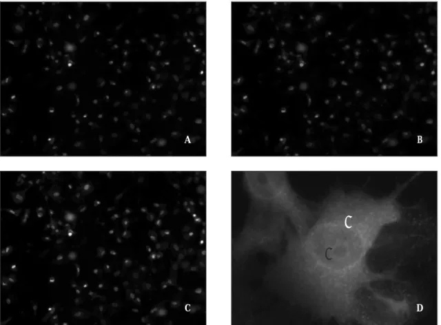 Fig. 2. Immunocytochemical analysis of the cellular distribution and patterns of expression of S100A7 antibody within CAL27(A, B and C)