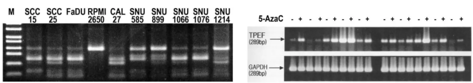 Table 2. Bisulfite sequencing of TPEF in HNSCC cell lines Cell lines  Total no.of clones Methylated CpG sites, average(%)