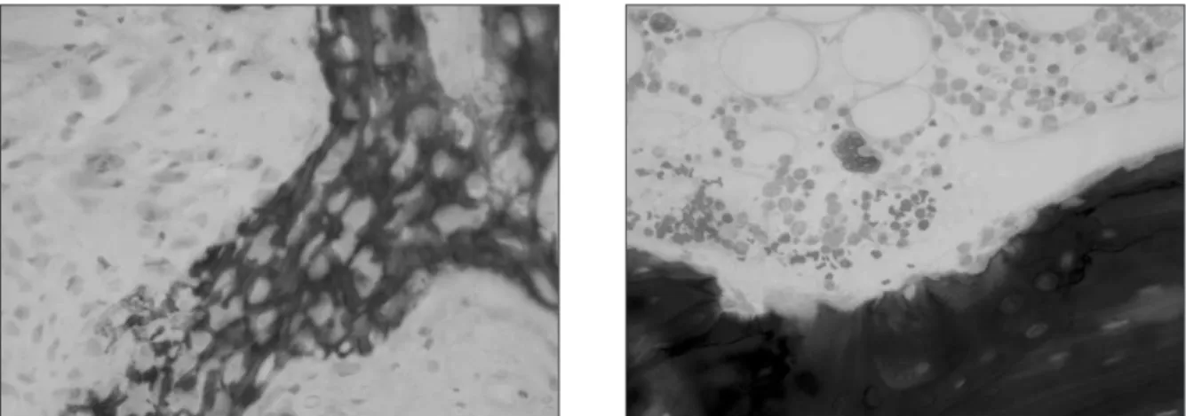 Fig. 5. Photomicrographs of control group (×400, H-E stain) : left, 3 weeks; right, 6 weeks.
