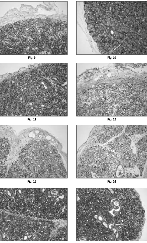 Fig. 9 Fig. 10