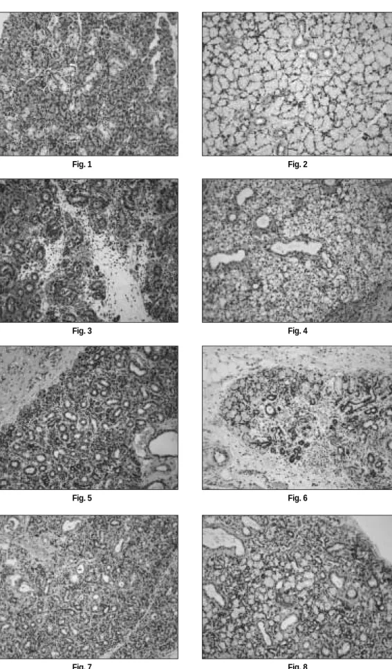 Fig. 1 Fig. 2