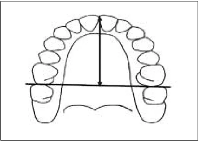 Fig. 6. Measurement of interdental and alveolar bone widths.