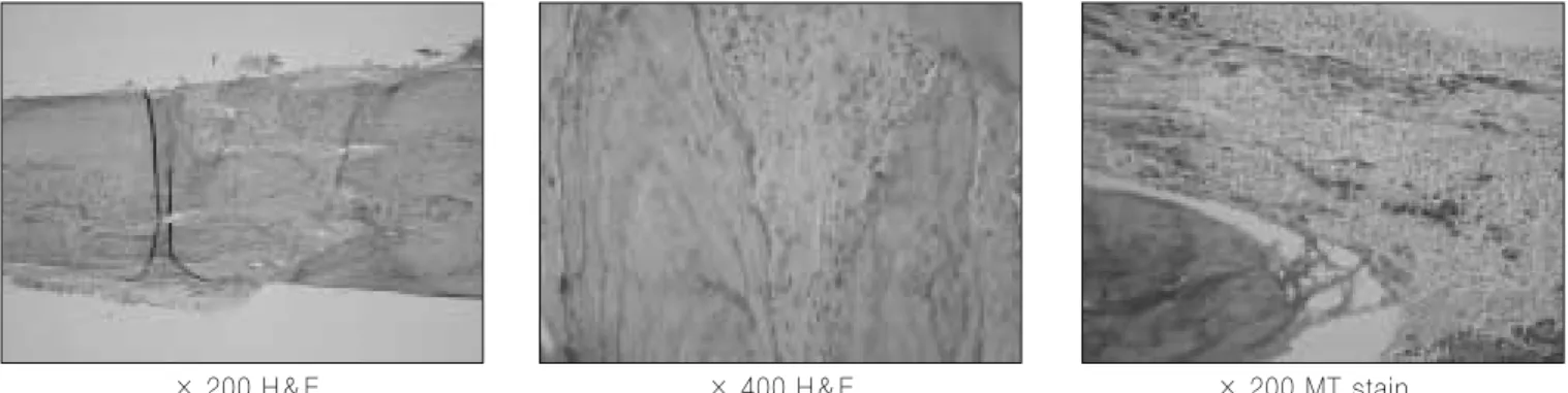 Fig. 9. H &amp; E and MT stainings in the first control group. 