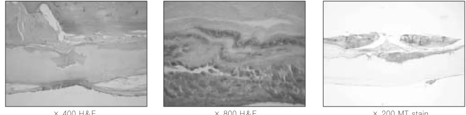 Fig. 15. H&amp;E and MT stainings in the second experimental group. 