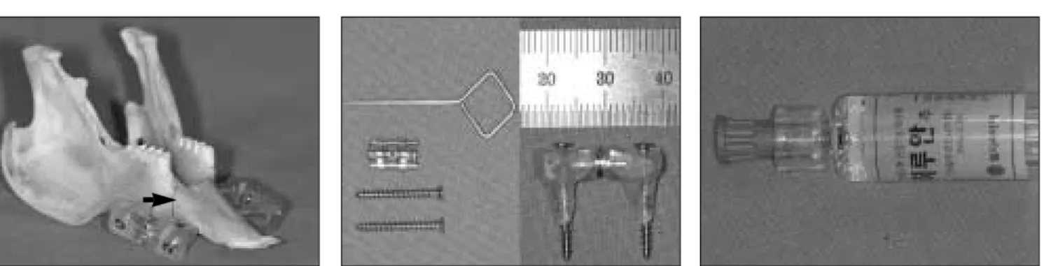 Fig. 1. Rabbit’s mandible and distraction design.