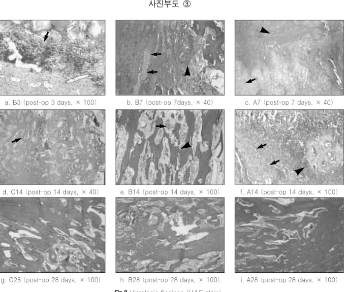 Fig. 9. Immunohistochemical expression of osteocalcin in post-op 3, 7, 14, and 28 days.