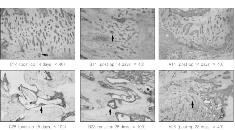 Fig. 11. RT-PCR analysis in osteocalcin of post-op 3, 7, 14, and 28 days.