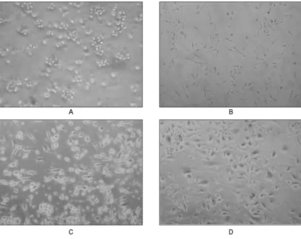 Fig. 1. Phase  contrast  images  of  CD34-  from  human  umbilical  cord  blood(UBC).  UBC-derived endothelial  progenitor  cells  at  0-4  days(A),  7-10  days(B),  14-20  days(C)  and  at  22-27  days (confluency)