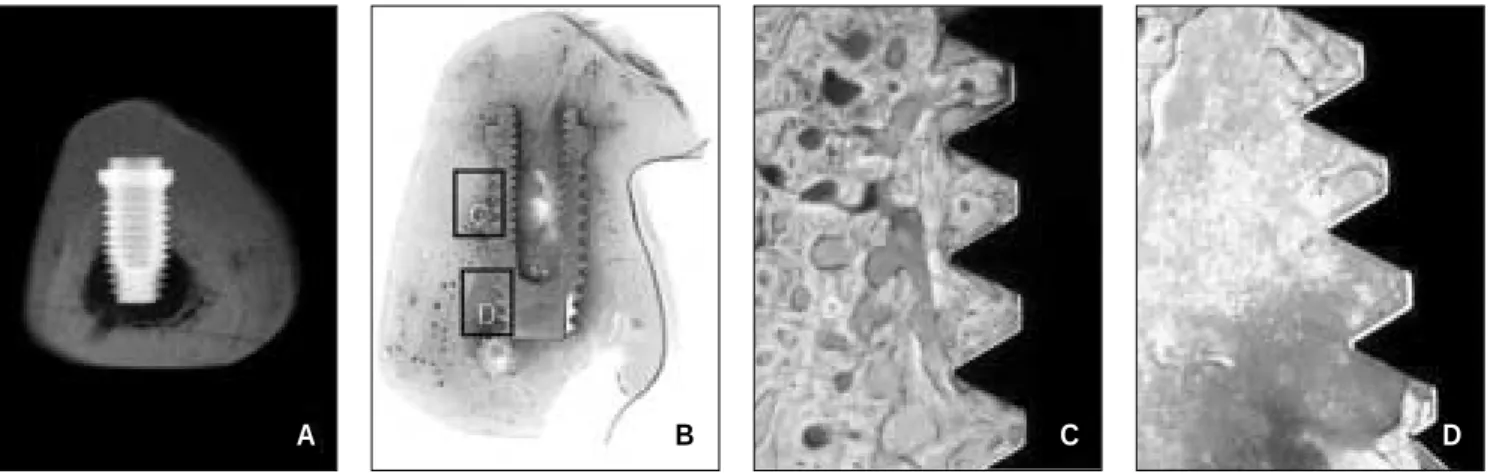 Fig. 1. Radiograph and photomicrographs of control group. A. The tibia has thick dense cortical bone and marrow space