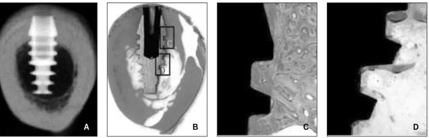 Fig. 4. Radiograph and photomicrographs of SLA group. A. Implant is placed in the tibia