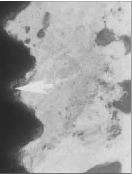 Fig. 6. 4th week HA implant group with saline irrigation (×100).  A  part  of  new  bone  was  in  contact  with hydroxyapatite layer of implant(white arrow)