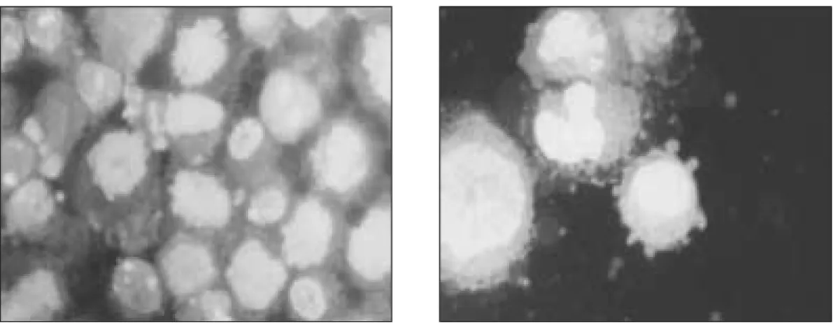 Fig. 5. AO/EB staining of HOS cells irradiated with 84 J/cm 2 laser light. Live cells still stain green (left  panel)  and  a  few  cells  apoptotic  morphology  which  appear  orange  due  to  co-stain  with ethidium bromide (right panel)