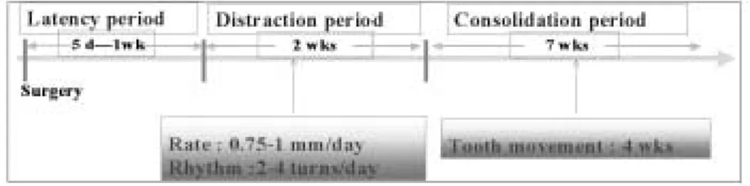 Fig. 4. Schematic diagram of distraction osteogensis