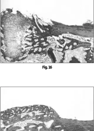 Fig. 17 Fig. 18
