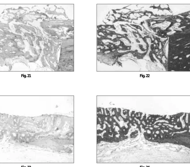 Fig. 21 Fig. 22