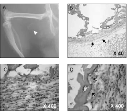 Fig. 1. Gel  chromatography  of  teeth  protein  in  the excluded peak of Sephadex G-75.