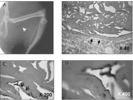 Fig. 4. SDS PAGE of fraction I protein extracted from human  teeth.  Gel  running  exhibited  four  clear bands at the sites corresponding to 66, 40, 20 and 18  kD