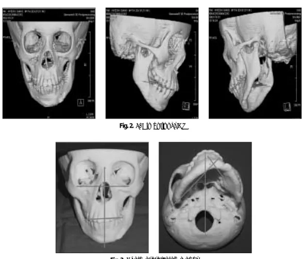 Fig. 2. 3-Dimentional CT