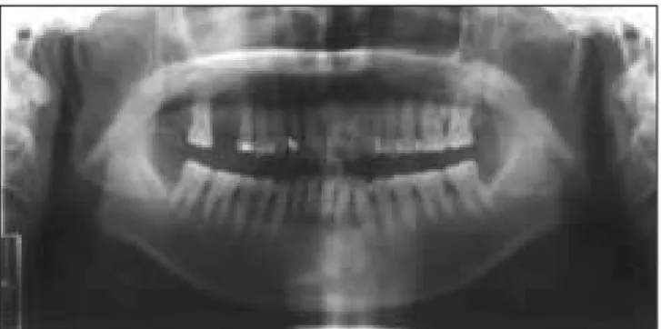 Fig. 2. Preoperative CT Fig. 3. Preoperative MR