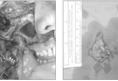Fig. 7. After 5 months, Follow-up