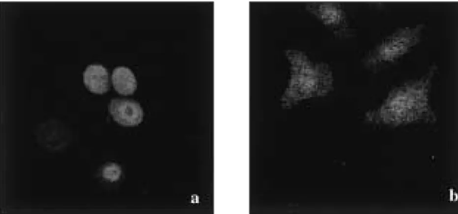 Fig. 7.  Confocal  microscopic  view  of  ER  in  oral  cancer  cell  lines,  note  the  diffuse expression of ER immunoreactivity mainly in the cytoplasm and cell membrane
