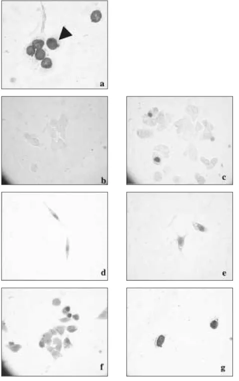 Fig. 3.  Apoptosis in Tamoxifen treated cell