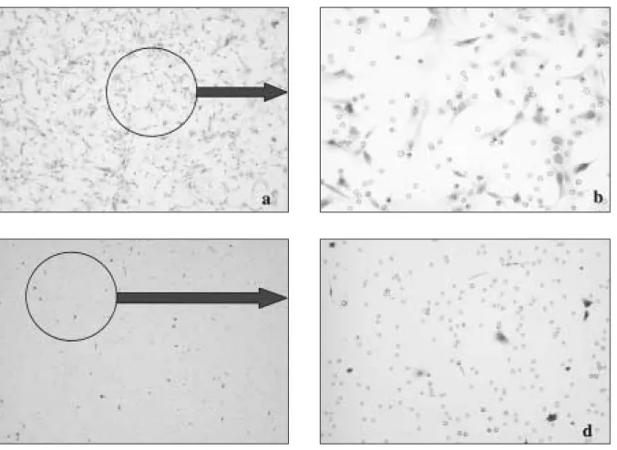 Fig. 4.  In vitro invasion assay