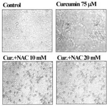 Fig. 10. Effect  of  curcumin  on  MMP2  and  9  activity.