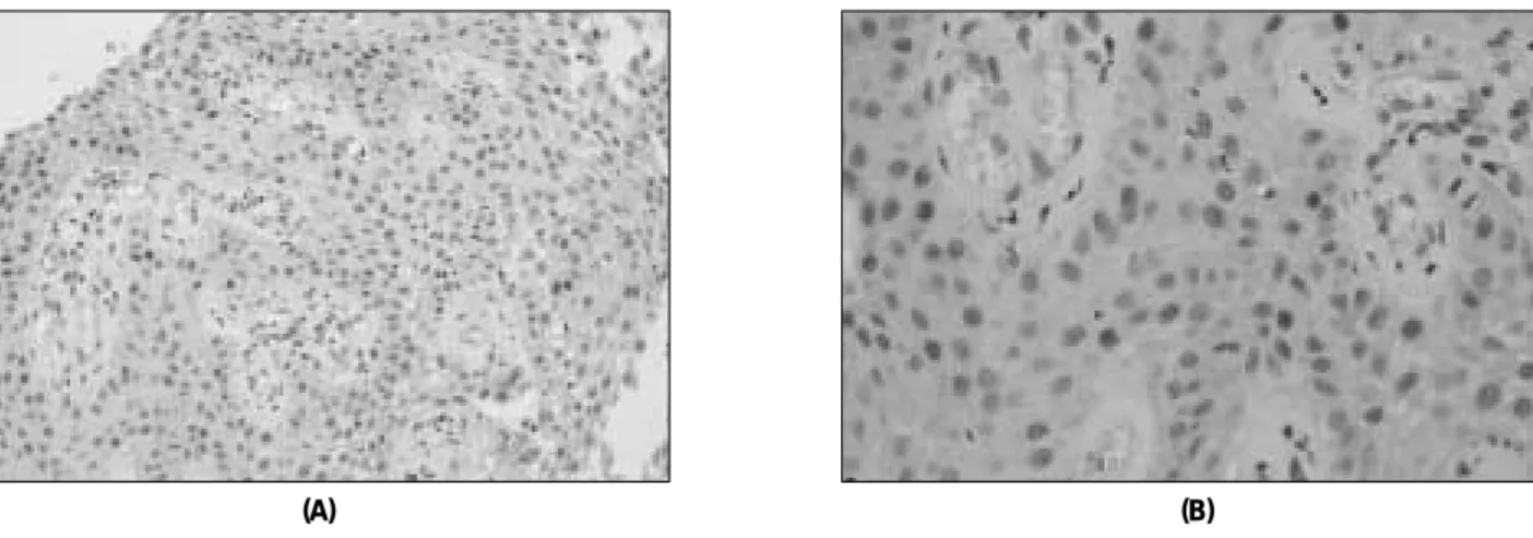 Fig. 3. Photography of p53 expression in normal gingiva with ×200(A) and ×400(B). p53 were expressed intensively in basal cell layer.
