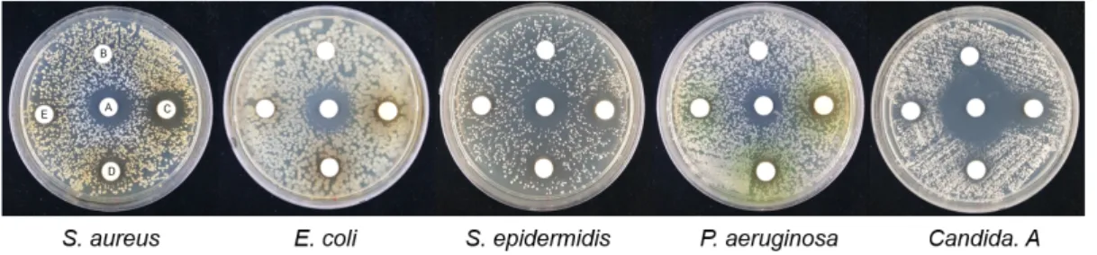 Fig.  3.  The  antimicrobial  activity  of  Butanol  fraction(BT)  was  determined  to  clear  zone  of  S
