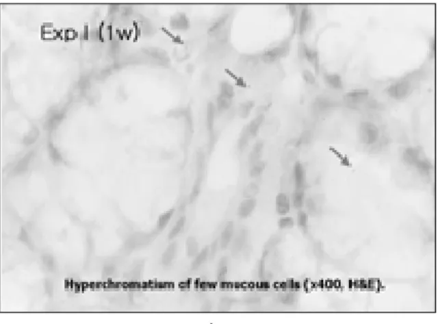 Fig. 11 Fig. 12