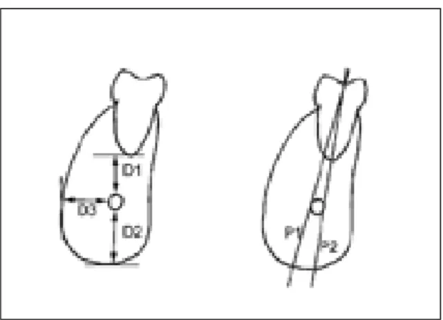 Fig. 1. schematic drawing of a tomographic section of mandibular  segment.  D1:The  distance  between  the upper  border  of  the  mandibular  canal  and  the  root apex  of  molar
