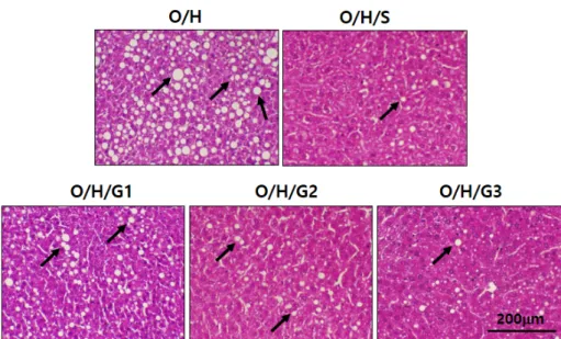 Fig.  4.  Effects  of  genistein  and  swimming  on  morphological  changes  in  hepatic  lipid  accumulation  in  high-fat  diet-fed  female  ovariectomized  mice