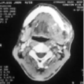 Fig. 6. Histopathologic finding