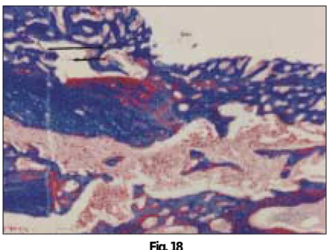 Fig. 18Fig. 17